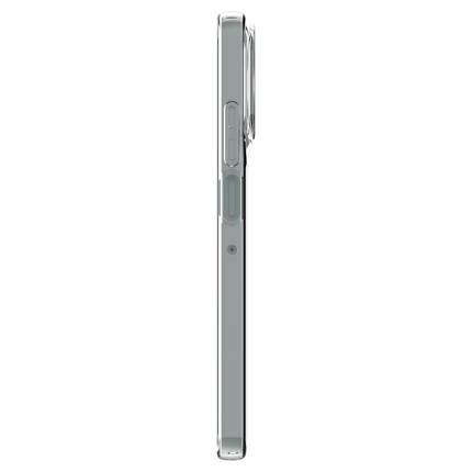 Lanyard Case - Motorola Moto G56 - Soft TPU Protective Cover with Necklace - Clear