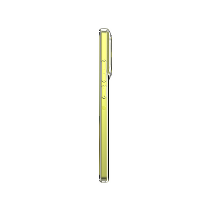 Lanyard Case - Motorola Moto G86 - Soft TPU Protective Cover with Necklace - Clear