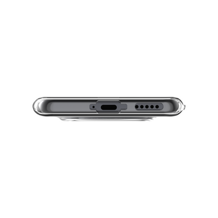 Lanyard Case - Xiaomi Redmi Note 15 (4G/5G) - Soft TPU Protective Cover with Necklace - Clear